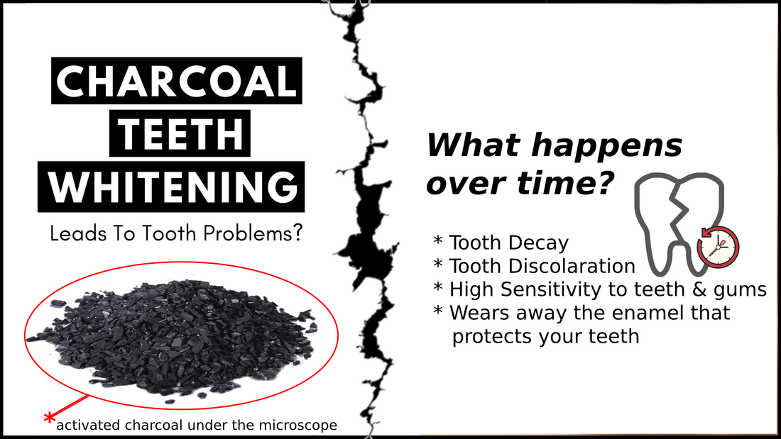 Activated Charcoal Teeth Whitening: Safe or Harmful?