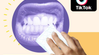 TIK TOK Dangerous Trend Alert: Magic Erasers & Teeth Whitening