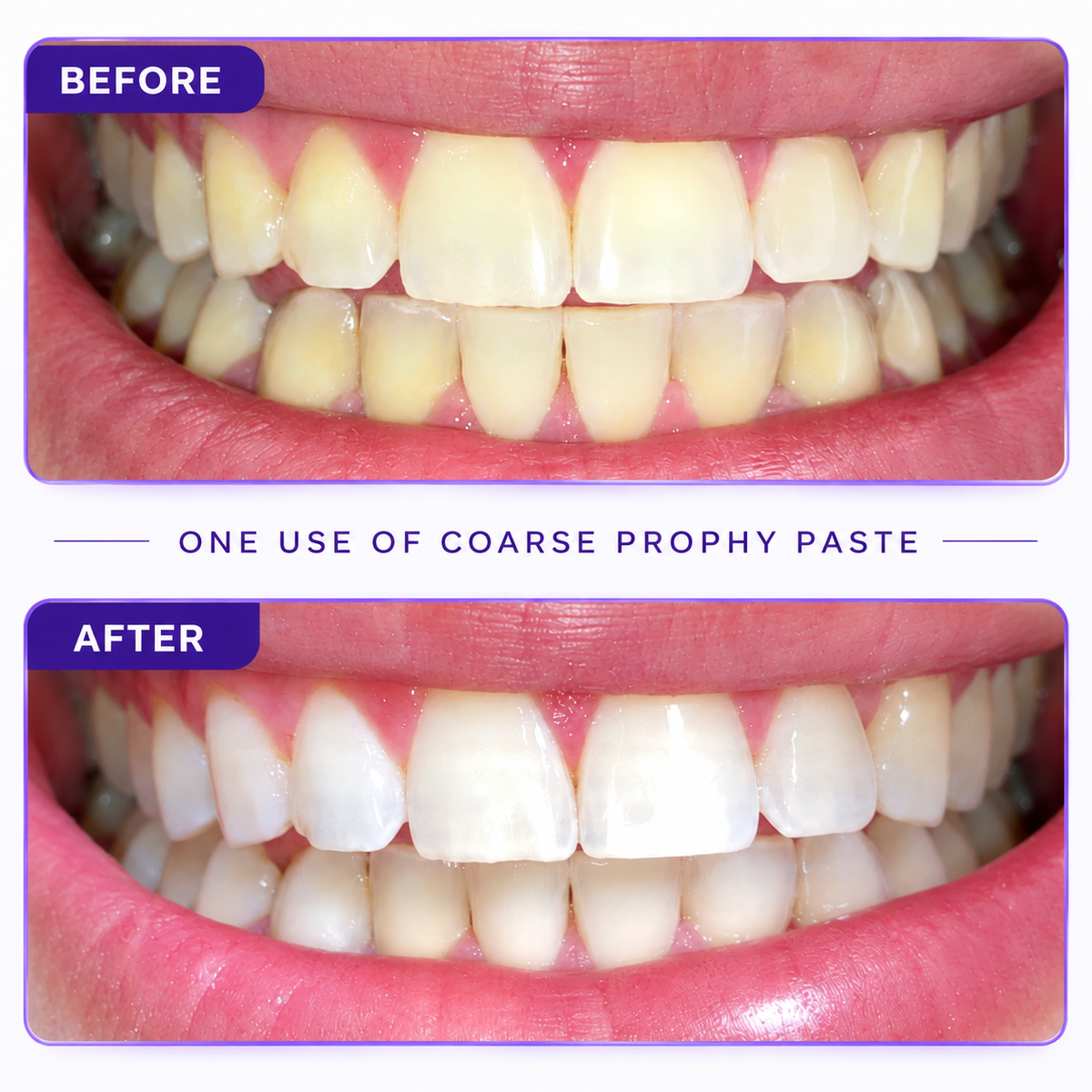 Whitening Prophy Paste FINE Mint Box of 200 Cups