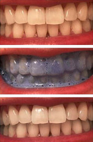 Color-Correcting Whitening Toothpaste  🌱 NEW Eco-Friendly Sugarcane Tube